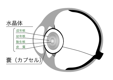 ウサギの白内障